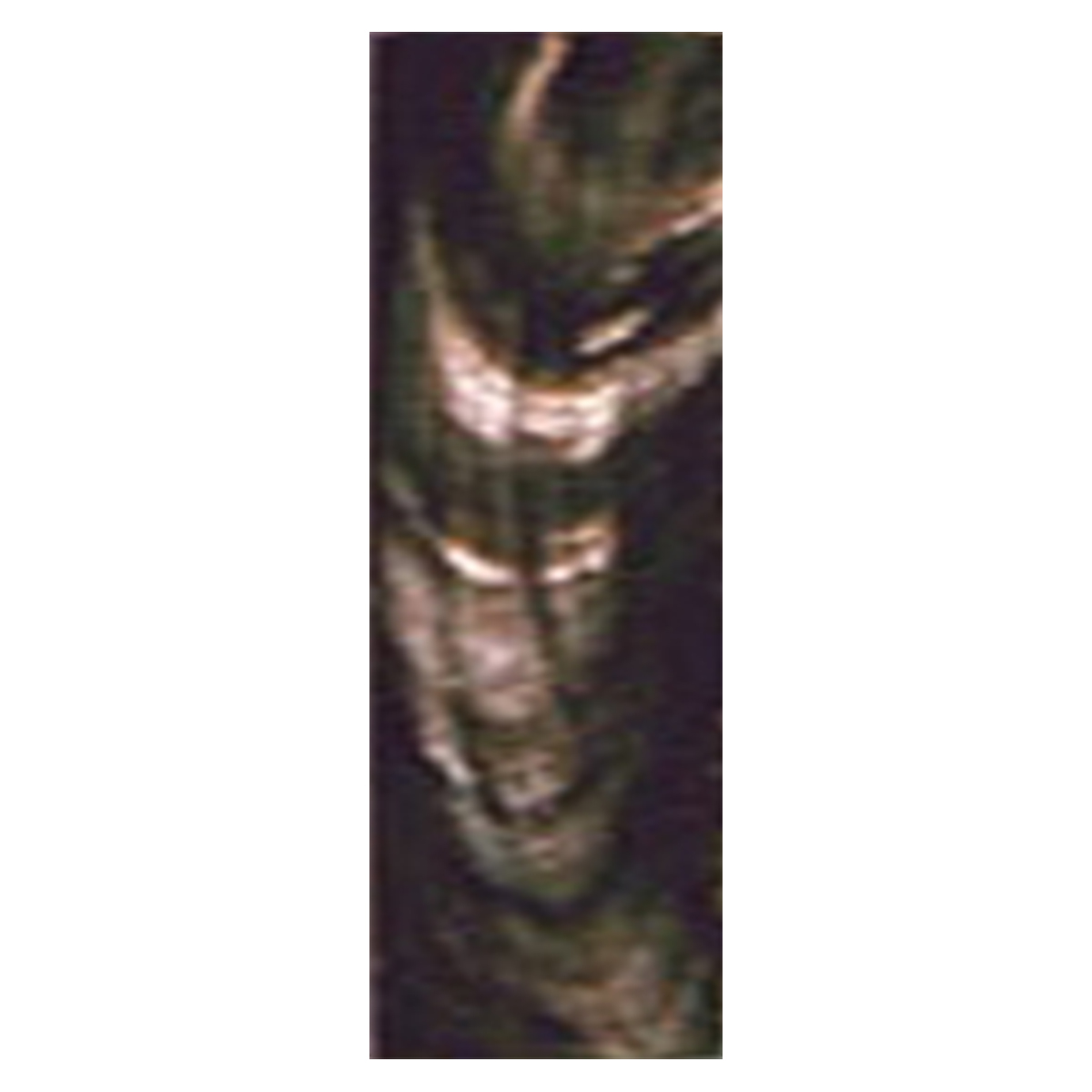 g5